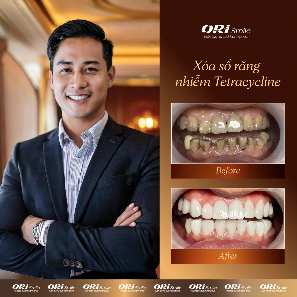 Hình ảnh khách hàng sử dụng dịch vụ tại Ori Smile