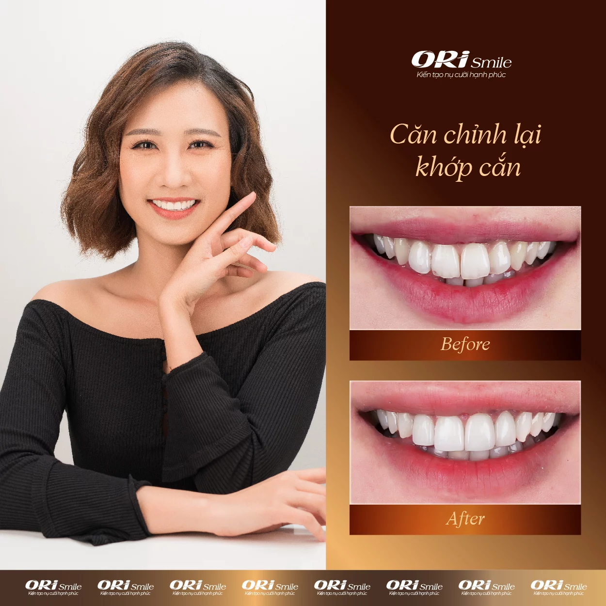 Hình ảnh khách hàng sử dụng dịch vụ tại Ori Smile
