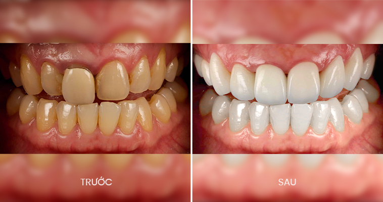 Nha khoa Ori Smile, Trung tâm nha khoa Ori Smile, Phòng khám nha khoa Ori Smile, Nha khoa thẩm mỹ quốc tế Ori Smile