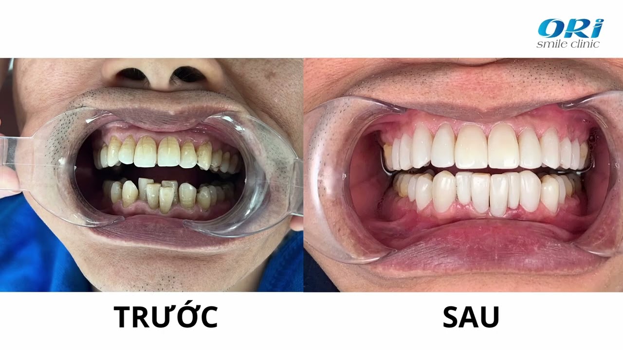 Nha khoa Ori Smile, Trung tâm nha khoa Ori Smile, Phòng khám nha khoa Ori Smile, Nha khoa thẩm mỹ quốc tế Ori Smile