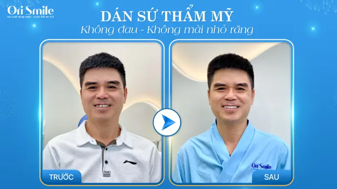 Chi tiết hình ảnh