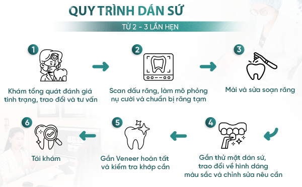 Quy trình dán sứ thẩm mỹ