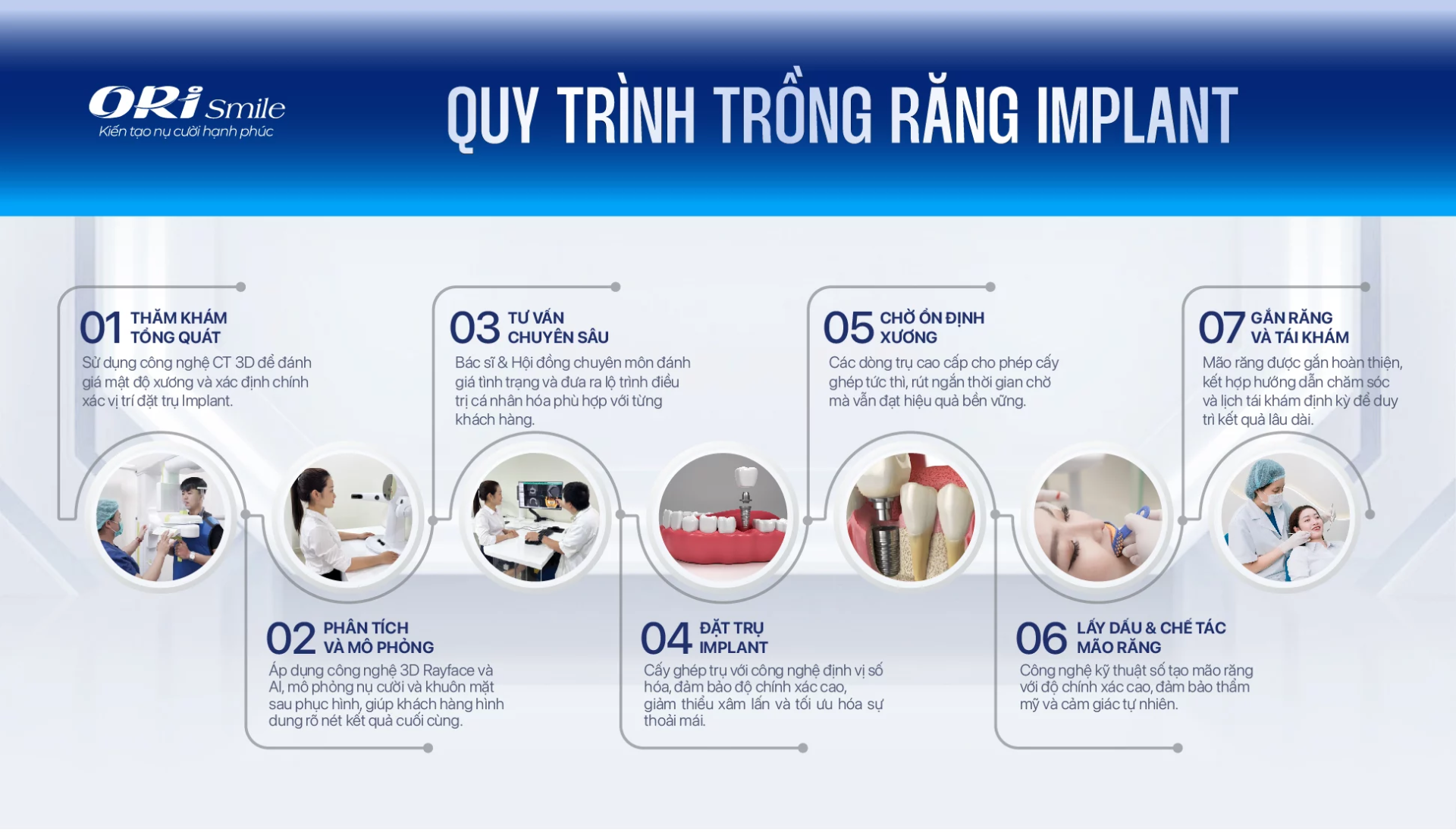 Quy trình cấy ghép Implant
