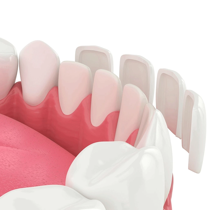 Ori Veneer Nano Prep +