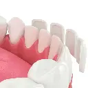 Ori Veneer Nano Prep +