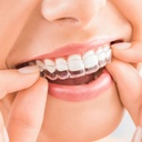 Niềng răng trong suốt Invisalign