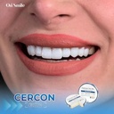 Răng sứ Cercon HT