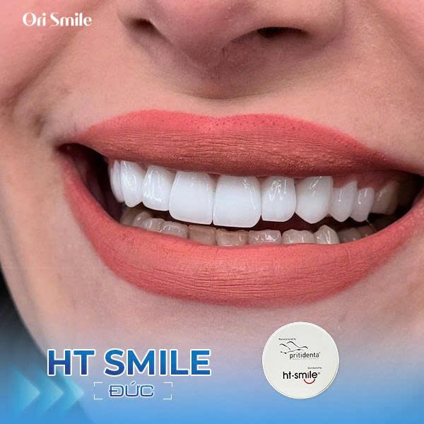 Răng sứ HT Smile 