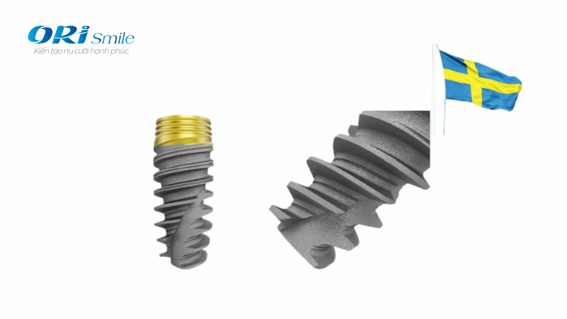 Hình ảnh trụ Implant Straumann và răng sứ